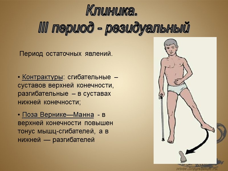 Клиника.  III период - резидуальный  Контрактуры: сгибательные – суставов верхней конечности, разгибательные